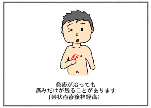 帯状疱疹の症状３