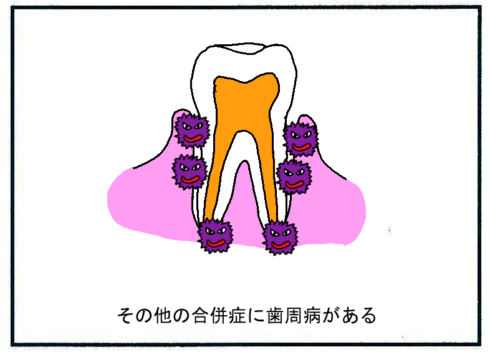 糖尿病の合併症である歯周病２